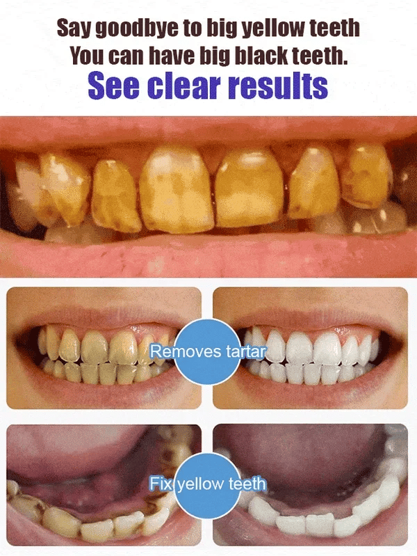 🔥Last Day 50% OFF🔥ODALIT™ Hydroxyapatite Toothpaste